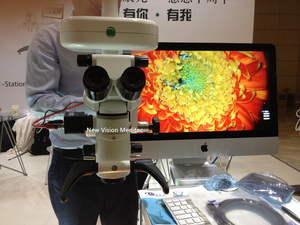 Bộ Chia Chùm Tích Hợp Và Bộ Chuyển Đổi <span class=keywords><strong>Camera</strong></span> <span class=keywords><strong>CCD</strong></span> Cho Kính Hiển Vi Phẫu Thuật - Product Image 5