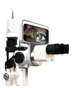 Kit oftalmik ponsel lampu celah modul pencitraan untuk mengambil gambar dan video