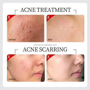 علامة خاصة آها Bha سيروم للوجه مضاد للشيخوخة مقشر توهج مرطب مضاد للتجاعيد مزيل البقع الداكنة تفتيح للوجه - Product Image 3