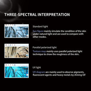 Microscope d'analyseur de peau de cheveux de détecteur de cuir chevelu LCD de 15.6 pouces pour le test de follicule pileux et la loupe d'analyse de peau 50/100/200X - Product Image 3