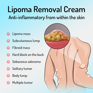 Crema para el cuidado de bultos de grasa, crema suave para el cuidado nutritivo diario, crema para el cuidado de bultos subcutáneos - Product Image 4