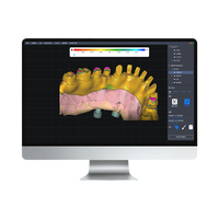 Software industriale digitale personalizzato per l'analisi della morfologia dei denti monitoraggio dell'usura apprendimento profondo AI piattaforme mobili/Desktop