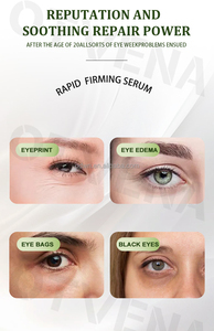Otvena ngay lập tức túi mắt loại bỏ dưới mắt Collagen Kem mắt túi loại bỏ kem - Product Image 6