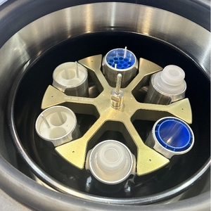 Phòng thí nghiệm tabletop chất béo chuyển tế bào gốc máy ly tâm <span class=keywords><strong>prp</strong></span> máy ly tâm - Product Image 5