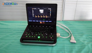 Escáner de imágenes médicas de pantalla grande con dispositivo <span class=keywords><strong>USG</strong></span> Doppler a color de 15,6 pulgadas con visualización clara para uso clínico - Product Image 4