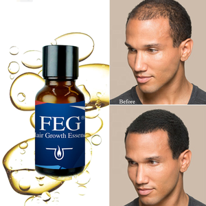 Siero Naturale per la Ricrescita dei Capelli per Donne Afroamericane con Etichetta Privata, con Olio di Ricino, Biotina, Rosmarino, Collagene e Cheratina - Product Image 4