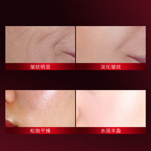 50% de réduction sur le prix de gros SADOER Neuropeptide Anti-rides Masque hydratant pour le visage Soins de la peau coréenne Hydratant Beauté Masque facial - Product Image 3