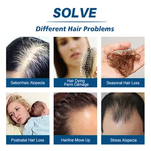 Anti-Trocknungs-Haarlösung Haaransatz Platycla Platycla Blattessenz schnelles Wachstum flüssige Essenz für Männer und Frauen