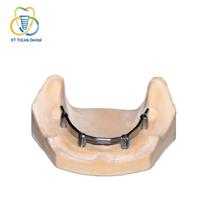 Implante Dental de Titanio Personalizado <span class=keywords><strong>CAD</strong></span> CAM de Fábrica, Accesorios para Implantes Dentales, Sistema de Restauración de Implantes, Implante Soportado - Product Image 2