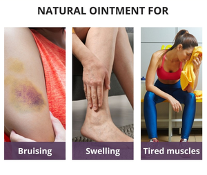 Balsamo all'<span class=keywords><strong>Arnica</strong></span> a Marchio Privato per Sollievo Rapido da Lesioni Sportive, Affaticamento, Contusioni e Gonfiori - Product Image 2