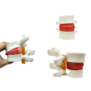 Sains medis Lumbar Disc Herniation Simulator tulang belakang Vertebral Model - Product Image 1