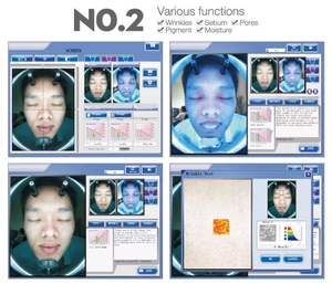 <span class=keywords><strong>BECO</strong></span>, superventas, análisis de piel 3D, escáner Facial, sistema analizador, escaneo facial, máquina automática de análisis de piel - Product Image 2