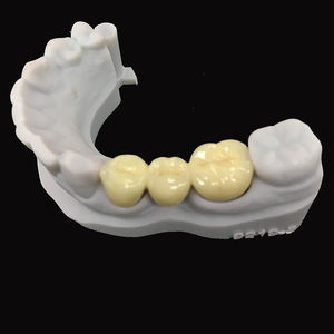 Restauración <span class=keywords><strong>fija</strong></span> Laboratorio dental asequible <span class=keywords><strong>Precio</strong></span> de China Puentes de corona de cerámica de metal <span class=keywords><strong>Precio</strong></span> barato Pfm - Product Image 2