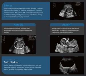 Appareil d'échographie Doppler couleur Sonoscape P11Elite 4D/5D avec fonction IA, chariot, pour les veines, le bébé, l'abdomen - Product Image 4