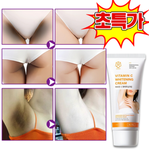 Melatonina pigmentazione crema per il corpo sbiancante 60g Wet Y Zone per l'anca del ginocchio gomito ascella inguine cura della pelle del corpo Whiton Ningbo presente - Product Image 1