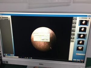 Ophthalmic Equipment Slit <b>Lamp</b> Digital Imaging Module Comparable with World-Class Slit <b>Lamp</b> Brands - Product Image 2