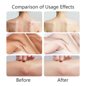 สบู่โคจิกแอซิดเพื่อผิวกระจ่างใส ผสมวิตามินซี ไนอะซินาไมด์ ลดเลือนจุดด่างดำ รอยสิว ฝ้า กระ จุดด่างดำ ช่วยให้ผิวขาวกระจ่างใส - Product Image 5