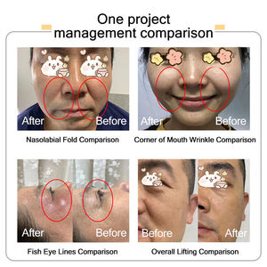 Machine de traitement anti-âge portable 7D pour le lifting du visage et l'élimination des rides FU, très vendue - Product Image 5