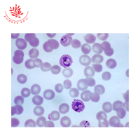 Plasmodium Vivax Microscope Slides Medical Science Parasitology Prepared Slides Microscope Prepared Slides