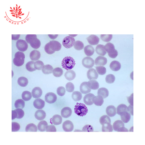 Слайды для микроскопа Plasmodium <span class=keywords><strong>Vivax</strong></span>, медицинская наука, паразитология, подготовленные слайды для микроскопа - Product Image 2