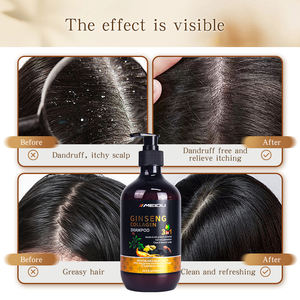 Shampoo anti-chute de cheveux de haute qualité à base de gingembre et de ginseng pour le contrôle du sébum - Product Image 3