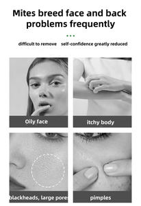 Jabón <span class=keywords><strong>de</strong></span> <span class=keywords><strong>Alepo</strong></span> orgánico <span class=keywords><strong>de</strong></span> aceite <span class=keywords><strong>de</strong></span> laurel 30% <span class=keywords><strong>5</strong></span> años-Mejor para eczema, dermatitis y piel seca-Jabón <span class=keywords><strong>de</strong></span> <span class=keywords><strong>Alepo</strong></span> certificado Halal <span class=keywords><strong>de</strong></span> <span class=keywords><strong>5</strong></span> años - Product Image 4