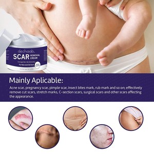 Crema trasparente Sakura Melasma Made in Korea per la rimozione della cicatrice Sakura - Product Image 5