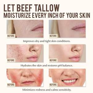 Unscented Natural Soft Smooth <span class=keywords><strong>Beef</strong></span> <span class=keywords><strong>Tallow</strong></span> Hautpflege Feuchtigkeit creme für Gesicht 100% gras gefütterter Rinder talg balsam - Product Image 6