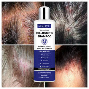 Shampoo antifongique pour la dermatite séborrhéique, <span class=keywords><strong>huile</strong></span> essentielle de théier pour le cuir chevelu, traitement de la folliculite, <span class=keywords><strong>huile</strong></span> essentielle pour les cheveux, vente chaude - Product Image 3