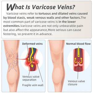 <span class=keywords><strong>Collant</strong></span> a compressione per calze Varicose medicali di grado 2 di maternità di tipo opaco 20-30mmHg - Product Image 6