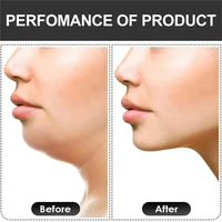 Appareil d'exercice pour les mâchoires et les muscles du visage, tonifiant le cou, pour un visage en V, réducteur de double menton, deux niveaux de résistance, protège-bouche