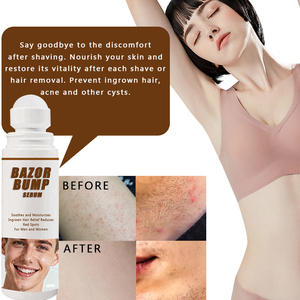 Sérum <span class=keywords><strong>anti</strong></span>-boutons de rasoir, marque privée, soin de la peau biologique avec acide hyaluronique, sans alcool, solution lisse pour les poils incarnés et la rasure - Product Image 3