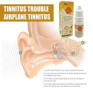 <span class=keywords><strong>Gocce</strong></span> auricolari ZB per alleviare il tinnito 10ml, alleviano il rumore nell'<span class=keywords><strong>orecchio</strong></span>, il prurito e la secchezza del condotto auricolare, liquido per la cura dell'<span class=keywords><strong>orecchio</strong></span> esterno. - Product Image 4