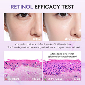 Groothandel SKINEVER Huidreiniging Verbeterd Elasticiteit 3A Retinol Collageen Verlichtende Zeep Gezichts- en Lichaamswas Retinol Zeep - Product Image 4