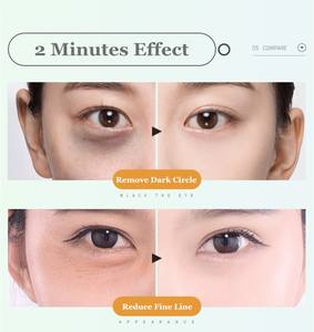 ต้องการตัวแทนจำหน่าย ครีมบำรุงรอบดวงตา Real Plus Beauty สำหรับลดรอยคล้ำใต้ตา - Product Image 2