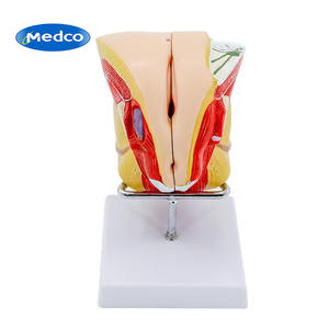 Modèle d'anatomie du système reproducteur féminin Medco avec structure ovarienne détachable pour la formation en chirurgie gynécologique - Product Image 1
