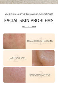 SET Perawatan Kulit Ekstrak Beras 5Pcs DR.ROSEVA Krim Wajah Toner Serum Pembersih Melembapkan Mengurangi Garis Halus Mencerahkan Warna Kulit - Product Image 5