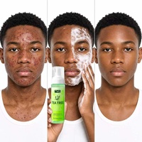 Nettoyant visage anti-acné TWG RTS Tea Tree Oil Control 200ml, nettoyant anti-acné pour hommes, nettoyant visage aux acides aminés