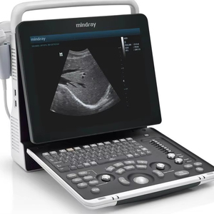 Ecógrafo Doppler Color Digital Portátil Mindray DP-50 VET/ DP 10/DP-30/DP-50 con Función Estable para Uso Veterinario - Product Image 1