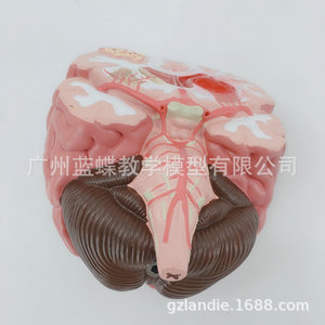 Anatomía del cerebro humano; modelo de cerebro/ictus; modelo de enfermedad cerebral; hemorragia cerebral; modelo anatómico de lesiones cerebrales. - Product Image 3