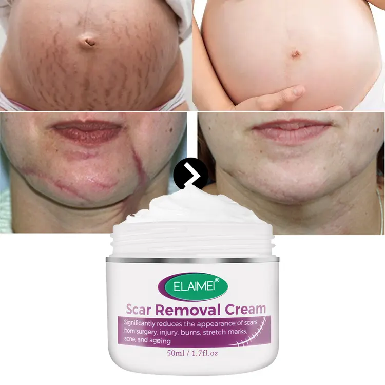 Logo personnalisé Crème pour le visage pour les blessures brûlures et cicatrices Crème lissante raffermissante anti-vergetures crème réparatrice pour toutes les cicatrices