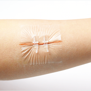 Dispositivo Transparente de Fechamento de Feridas com Zíper, Sem Dor, com Agulhas de Sutura, Redutor de Feridas, Adesivos de Ajuda para Sutura com Zíper - Product Image 1