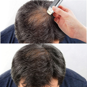Kit de Microinfusión para el Crecimiento del Cabello, Masajeador de Cabeza con Sello <span class=keywords><strong>Derma</strong></span> Renewal Dorado - Product Image 6