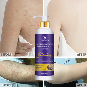glutathione iv side effects headache chills Glutathione IV Detox – Your Shortcut to Feeling Fabulous