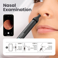 Kit de contrôle visuel intelligent pour la santé des oreilles, de la bouche et du nez, accessoire ORL, caméra pour le nettoyage des cérumen, appareil portable pour usage domestique, fournitures de nettoyage