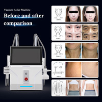 Machine de raffermissement cutané par aspiration à 360° pour salon de beauté, spa, drainage lymphatique, réduction de la cellulite, circulation sanguine
