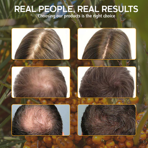 แชมพูบาร์ออร์แกนิค บาตา<span class=keywords><strong>น</strong></span>า ออยล์ สำหรับ<span class=keywords><strong>ผม</strong></span>หยิก ช่วยบำรุงผมให้ชุ่มชื้นอย่างเป็<span class=keywords><strong>น</strong></span>ธรรมชาติ ยี่ห้อ Joynna Wholesale Leaf Amino Gentle Hotels  ช่วยเร่งการเจริญเติบโตของเส้<span class=keywords><strong>น</strong></span>ผม - Product Image 4