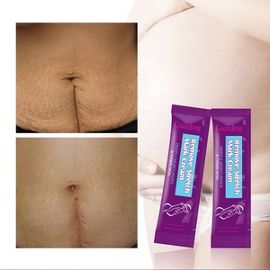 Private Label cura <span class=keywords><strong>della</strong></span> pelle di maternità naturale Anti smagliature Anti cicatrice crema per la rimozione delle smagliature organiche - Product Image 2