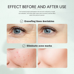 Tonique Visage Hydratant et Éclaircissant à l'Acide Hyaluronique Naturel Végétalien en Gros avec Logo Personnalisé en Forme de Spray - Product Image 4