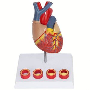 Modelo <span class=keywords><strong>de</strong></span> corazón KyrenMed corazón con modelo <span class=keywords><strong>de</strong></span> trombo - Product Image 1